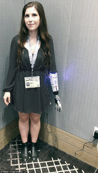 美残疾女子为高科技假肢充电照片网上引热议