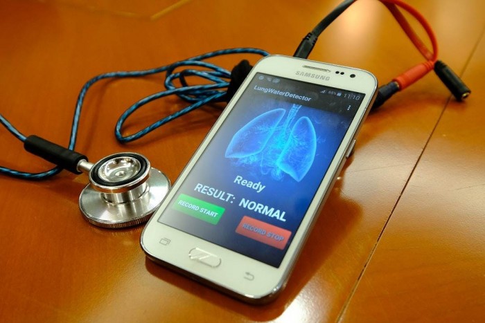 科学家打造听诊器式声学传感器：能听出充血性心衰
