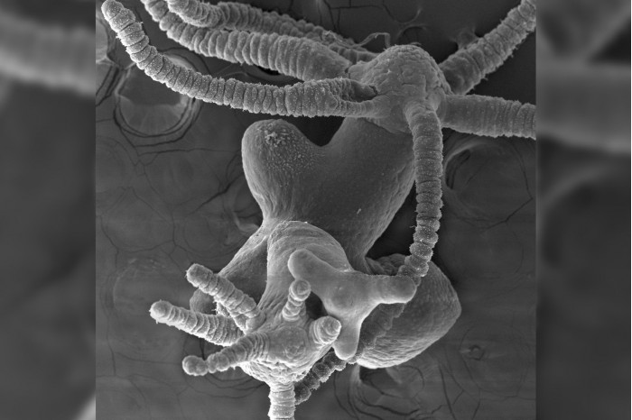 科学家在实验室里培育的多头怪物或有助于癌症研究