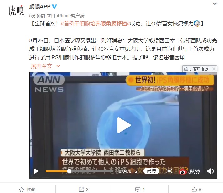 全球首例人工干细胞培养眼角膜移植成功，40岁盲女恢复视力