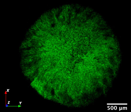 科学家发现细菌生物膜的“死星”式弱点