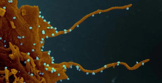 多款抗癌药显露抗病毒潜力 阻止新冠病毒劫持细胞