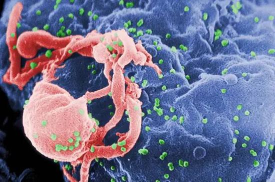 艾滋病有可能“自愈”？罕见防御力不用药物也能控制HIV感染