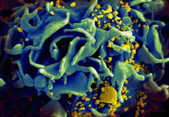 HIV病毒抑制速度翻倍：艾滋病CAR-T疗法要来了？