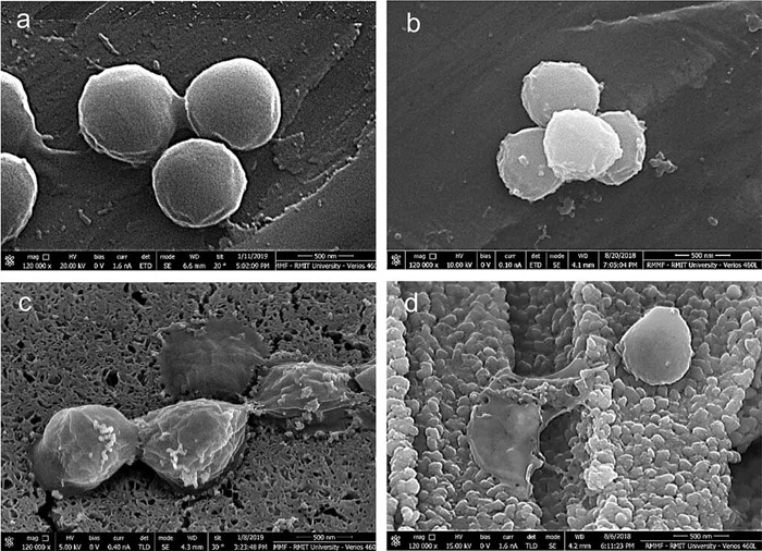 科学家研发出新型多孔铜：杀死金色普通球菌的速度是普通铜的120倍